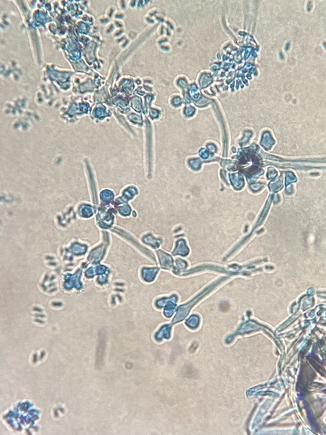 Hongo teñido al microscopio