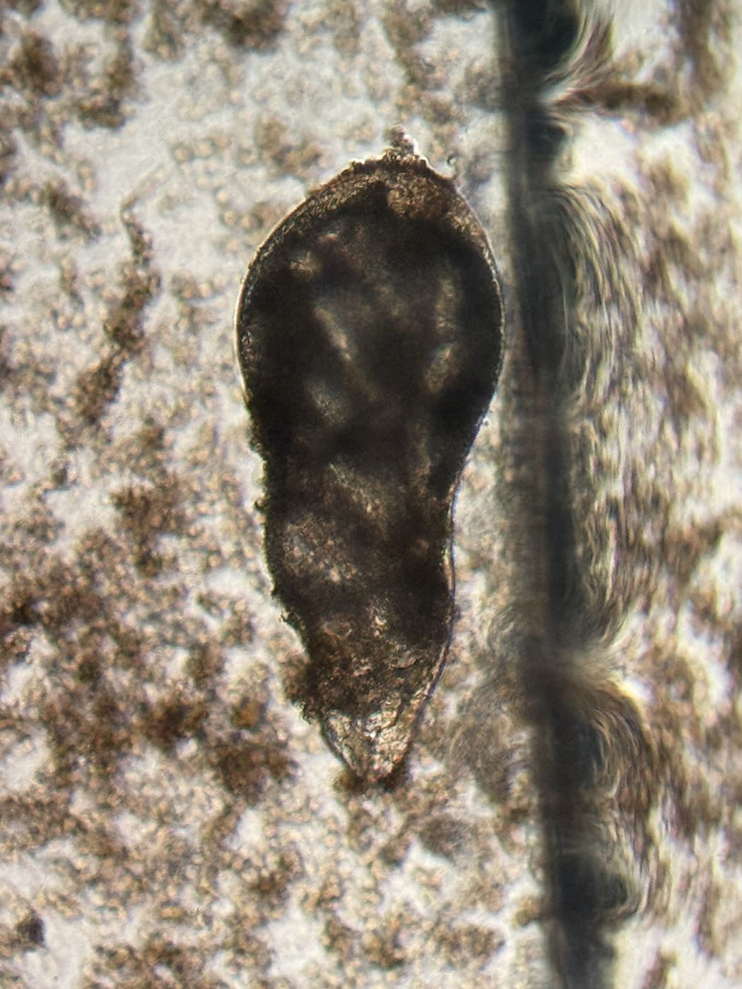 Hallazgo al microscopio en una muestra de raíz
