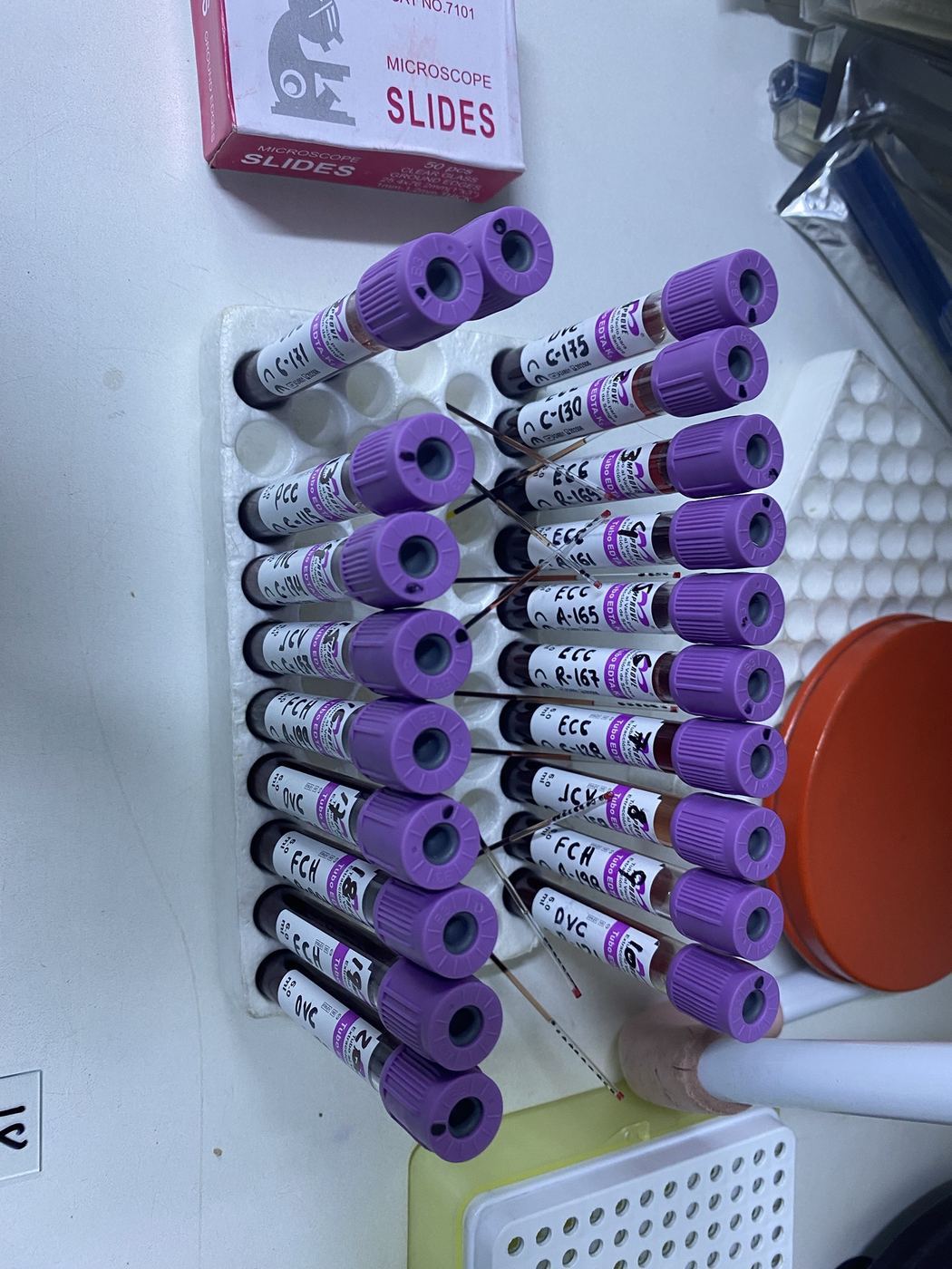 Tubos de muestra rotulados